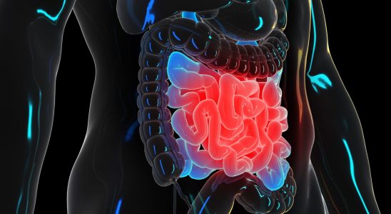 Intestinal obstruction symptoms death when to worry