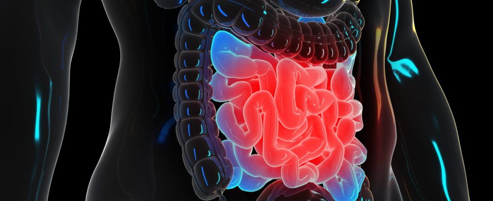 Intestinal obstruction symptoms death when to worry