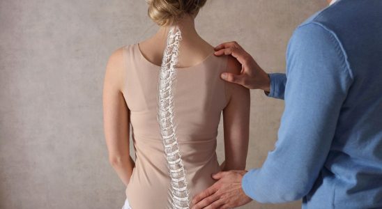 June 26th is International Scoliosis Screening Day