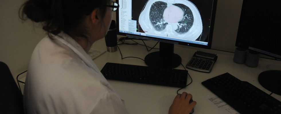 Lung cancer AstraZenecas new therapeutic weapon that could save lives