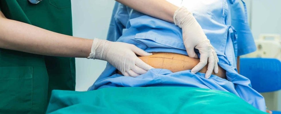 Obesity bariatric surgery reduces the risk of cancer by 50