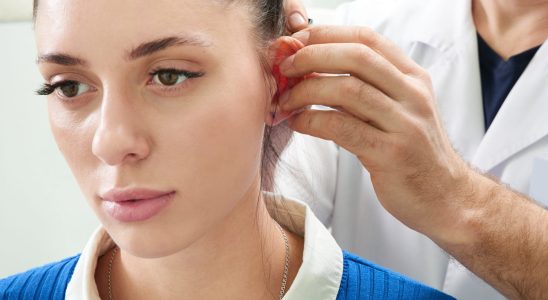 Otoplasty what is the operation of protruding ears