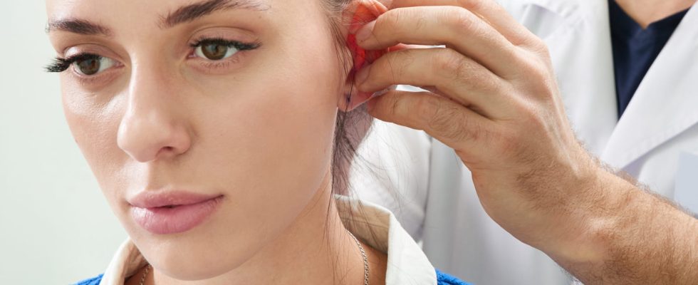 Otoplasty what is the operation of protruding ears