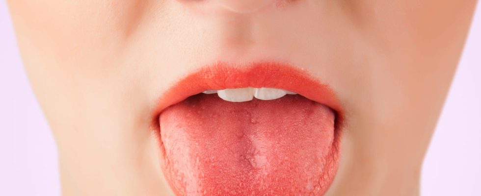 Pimples on the tongue causes photo what to do