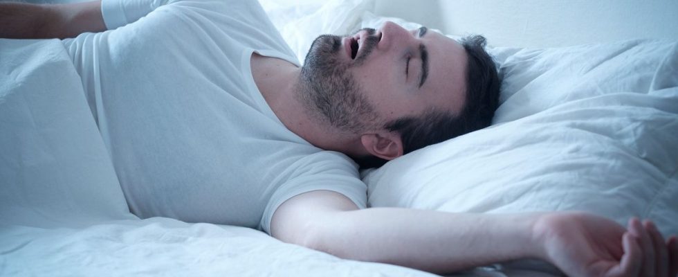 Sleep apnea increases the risk of Alzheimers