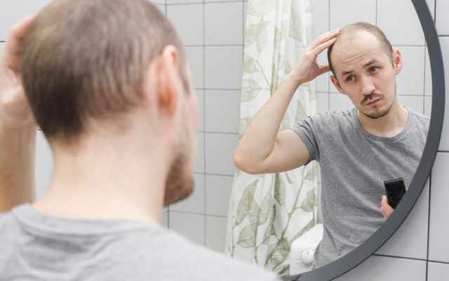 The surprising reason for permanent hair loss If you dont