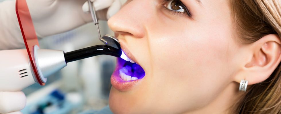 Tooth decay photo symptoms how to treat it