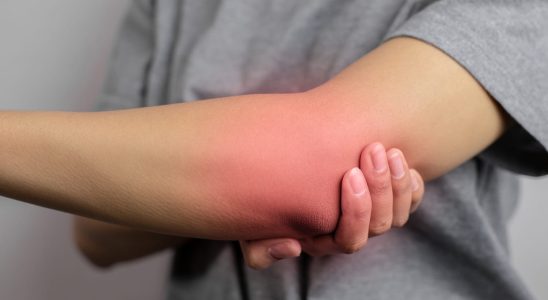 What are the signs of inflammation