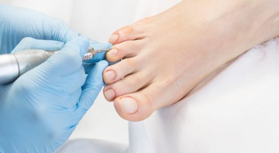 What does a Pedicure Podiatrist treat