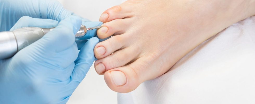 What does a Pedicure Podiatrist treat