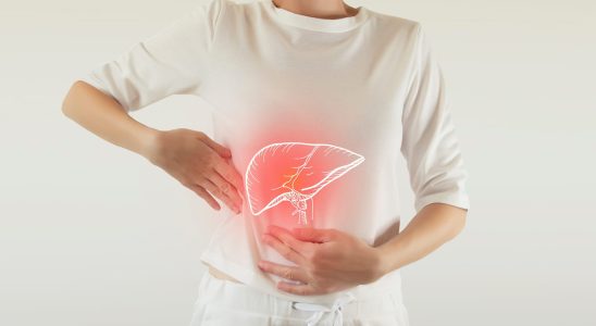 What is MAFLD the new liver disease that worries