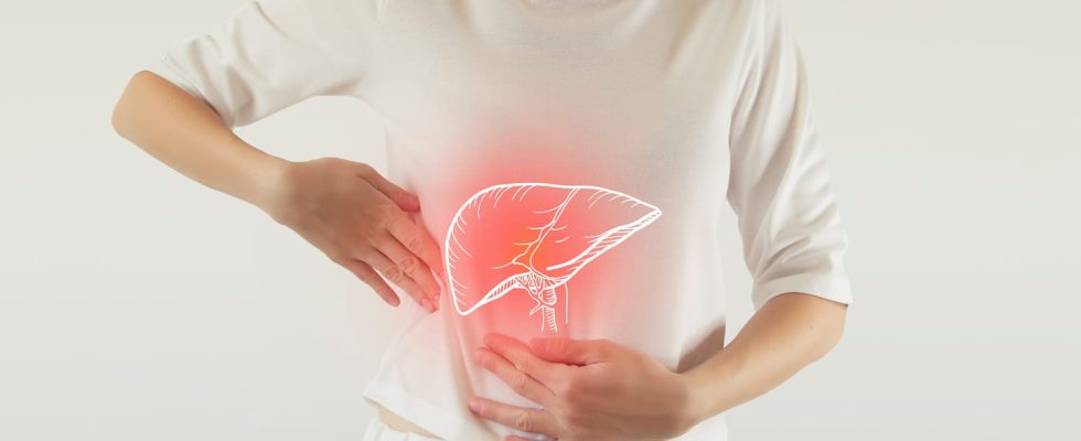 What is MAFLD the new liver disease that worries