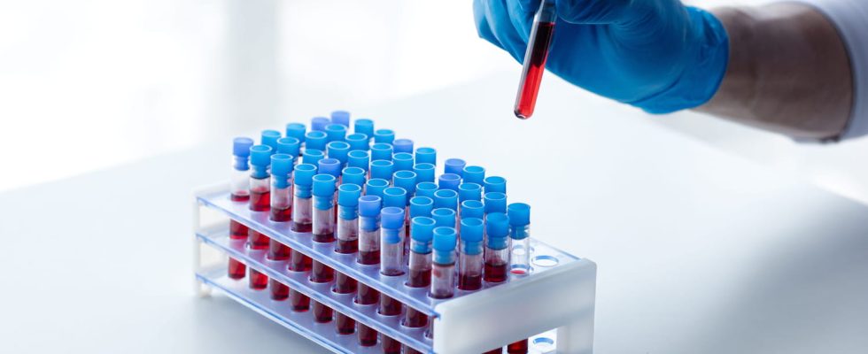 Carcinoembryonic antigen CEA assay standards