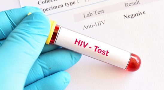 HIV the Geneva patient declared in remission after a bone