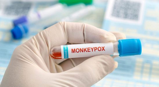 Monkey pox beware of the potential resurgence of cases at