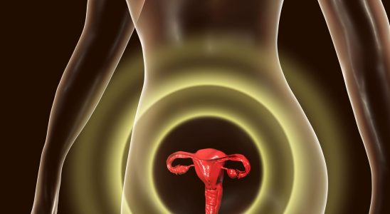 Uterus diseases what are the different forms