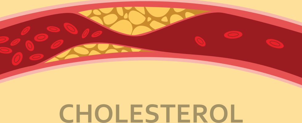 What is the difference between HDL and LDL cholesterol