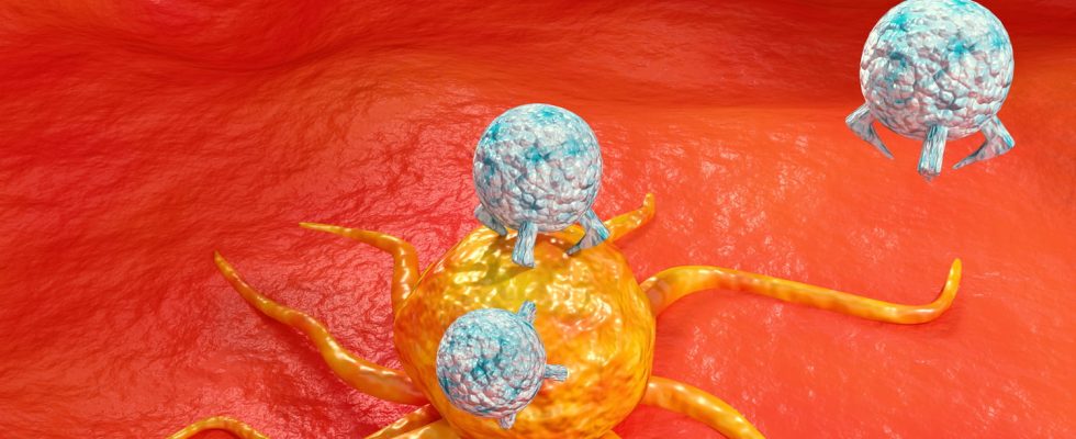 A new treatment capable of reducing cancer metastasis