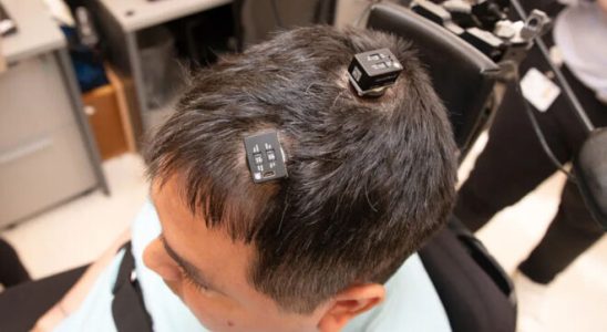 Brain implant helped a patient regain feeling