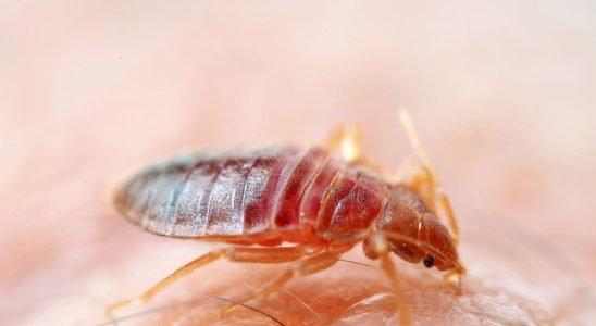 Lice in hospitals combated with steam