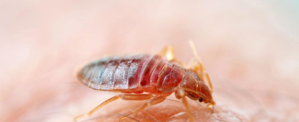 Lice in hospitals combated with steam