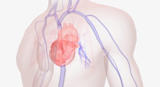 Coronarography to see the heart duration rest afterwards