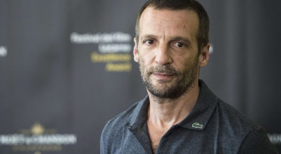 Mathieu Kassovitz out of a coma several operations What is