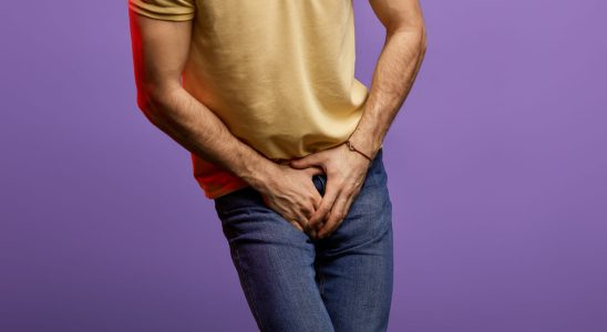 Peyronies disease treating this deformity of the penis