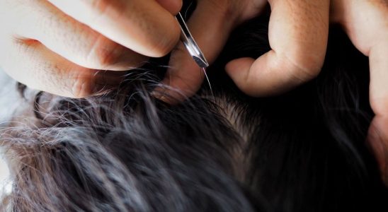 Does pulling out one gray hair really cause others to