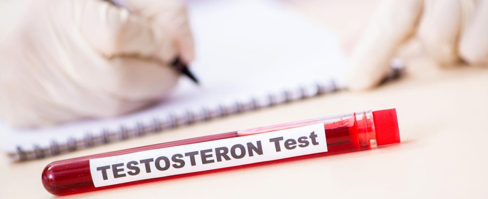 What is testosterone Definition role and normal rate