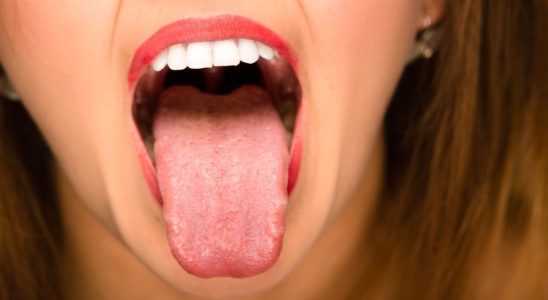 What your tongue can reveal about your health