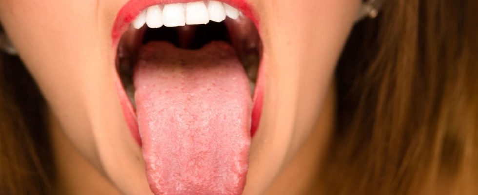 What your tongue can reveal about your health