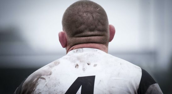 Why do rugby players have cauliflower ears