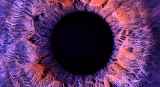 World first an eye made transparent to better understand eye