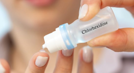 Chlorhexidine stop using it if you have these allergy symptoms