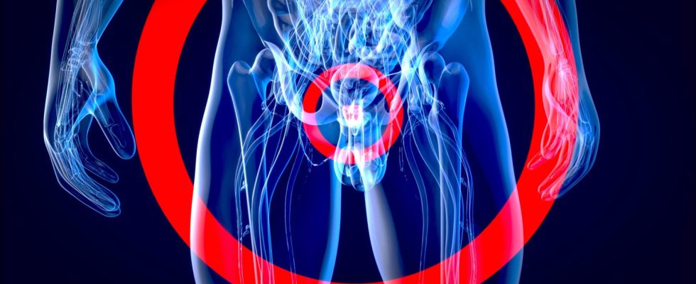 Prostate cancer the first symptoms that should alert men