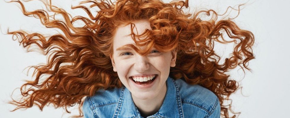 Redheads feel pain differently