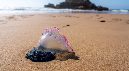 Sea bladder how to relieve a snail sting