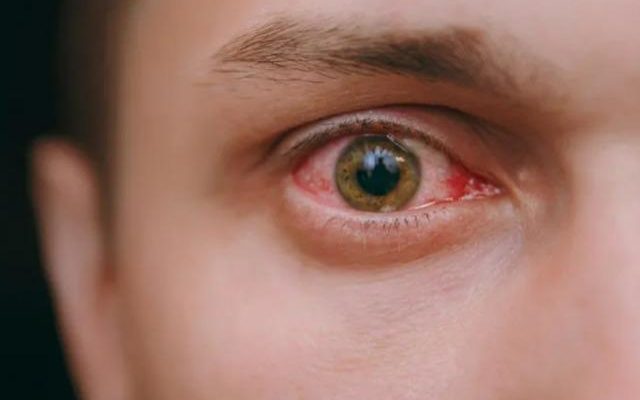 This symptom in the eyes is a warning sign of