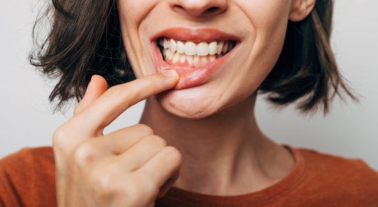 What to do about tooth loss