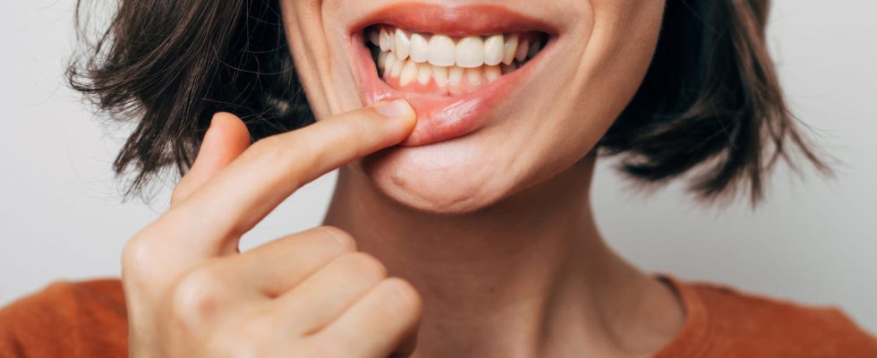 What to do about tooth loss