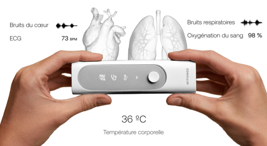 Withings presents its BeamO multiscope at CES in Las Vegas