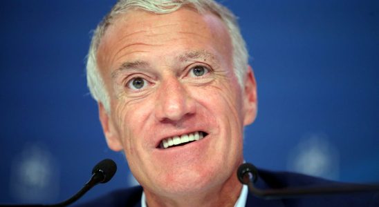 1708842699 His case was extremely complex Didier Deschamps new teeth cost