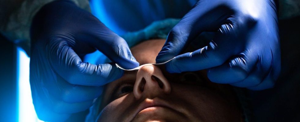 Aesthetic medicine the market slowed down in 2023 acceleration in