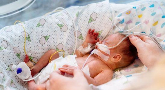 United States one in ten premature births are linked to