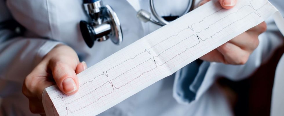 Screening for atrial fibrillation directly with your GP could reduce