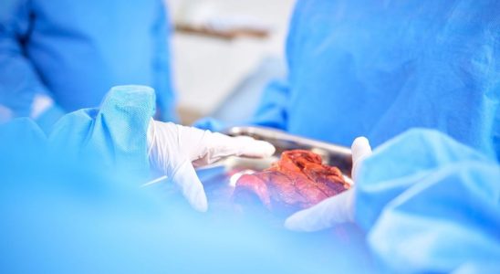 World first a genetically modified pig kidney was transplanted into