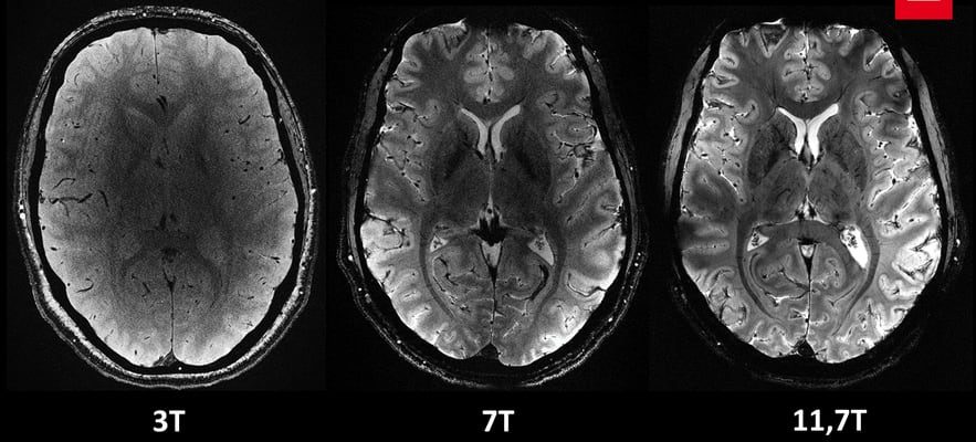 its first images revealed – LExpress