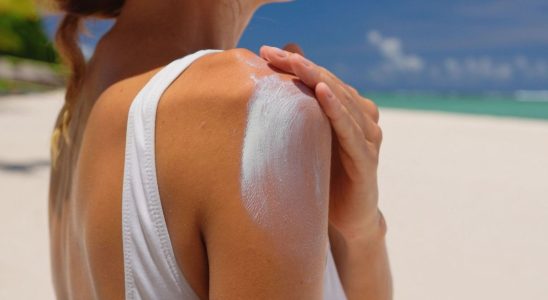 Faced with the Anti sunscreen trend dermatologists are seeing red We