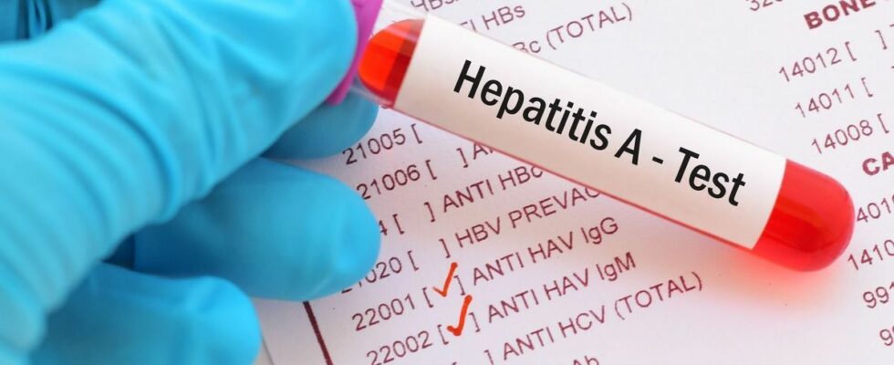 Several cases of hepatitis A contamination in the city of